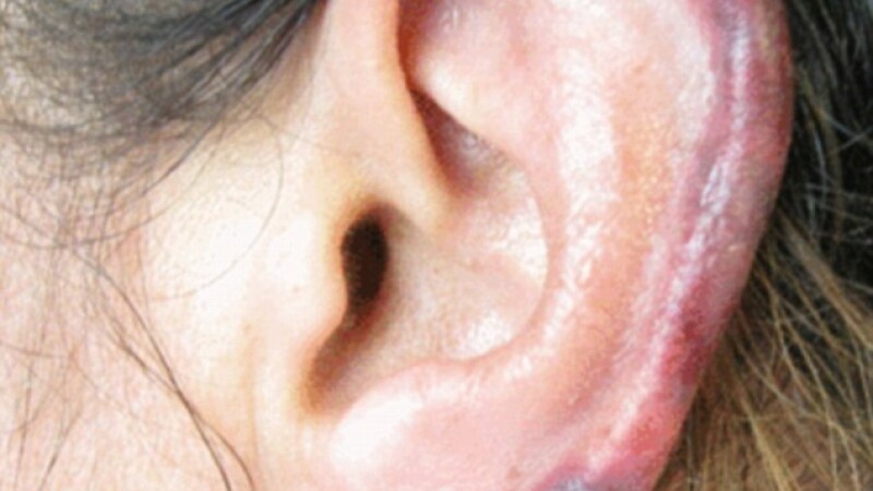 cocaina