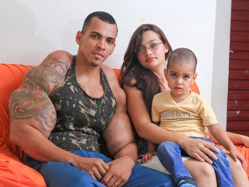 Brazilianul dependent de injectii cu ulei, poreclit Incredibilul Hulk, isi spune povestea