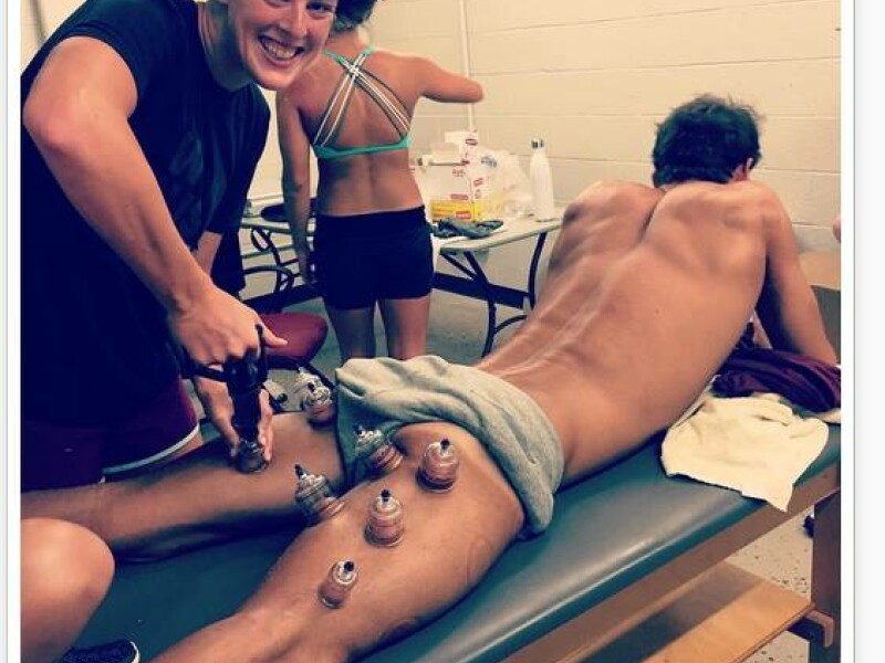 Toata lumea a observat petele rosii de pe spatele lui Michael Phelps! Ce sunt aceste semne