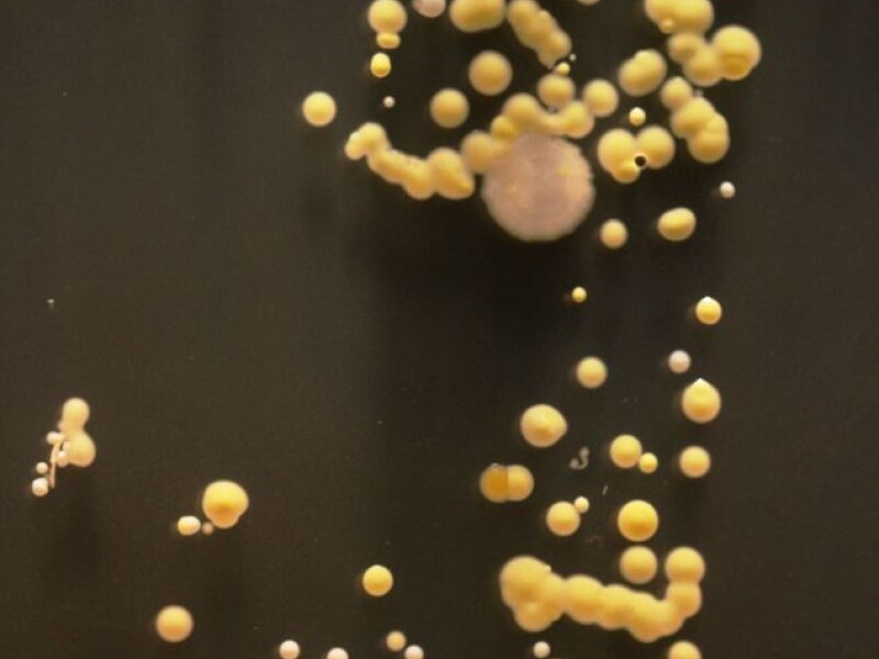 bacterii