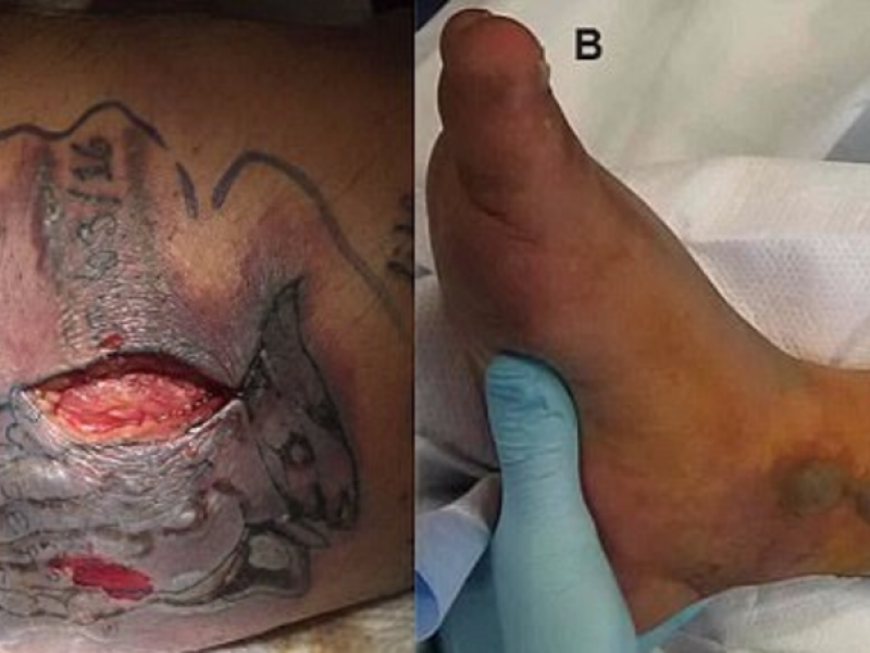 Un barbat a murit la putin timp dupa ce si-a facut un tatuaj! Sfatul pe care l-a ignorat