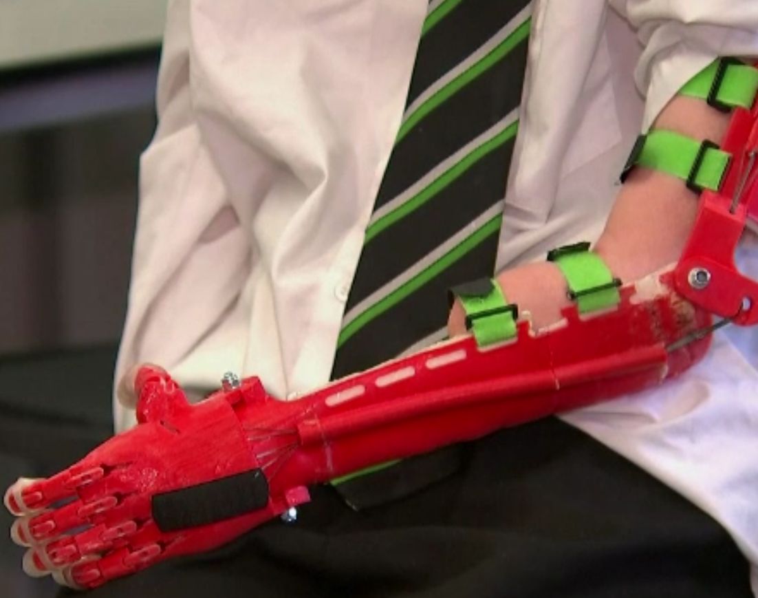 Mână bionică, realizată de un profesor pentru elevul său. Suma infimă pe care a cheltuit-o