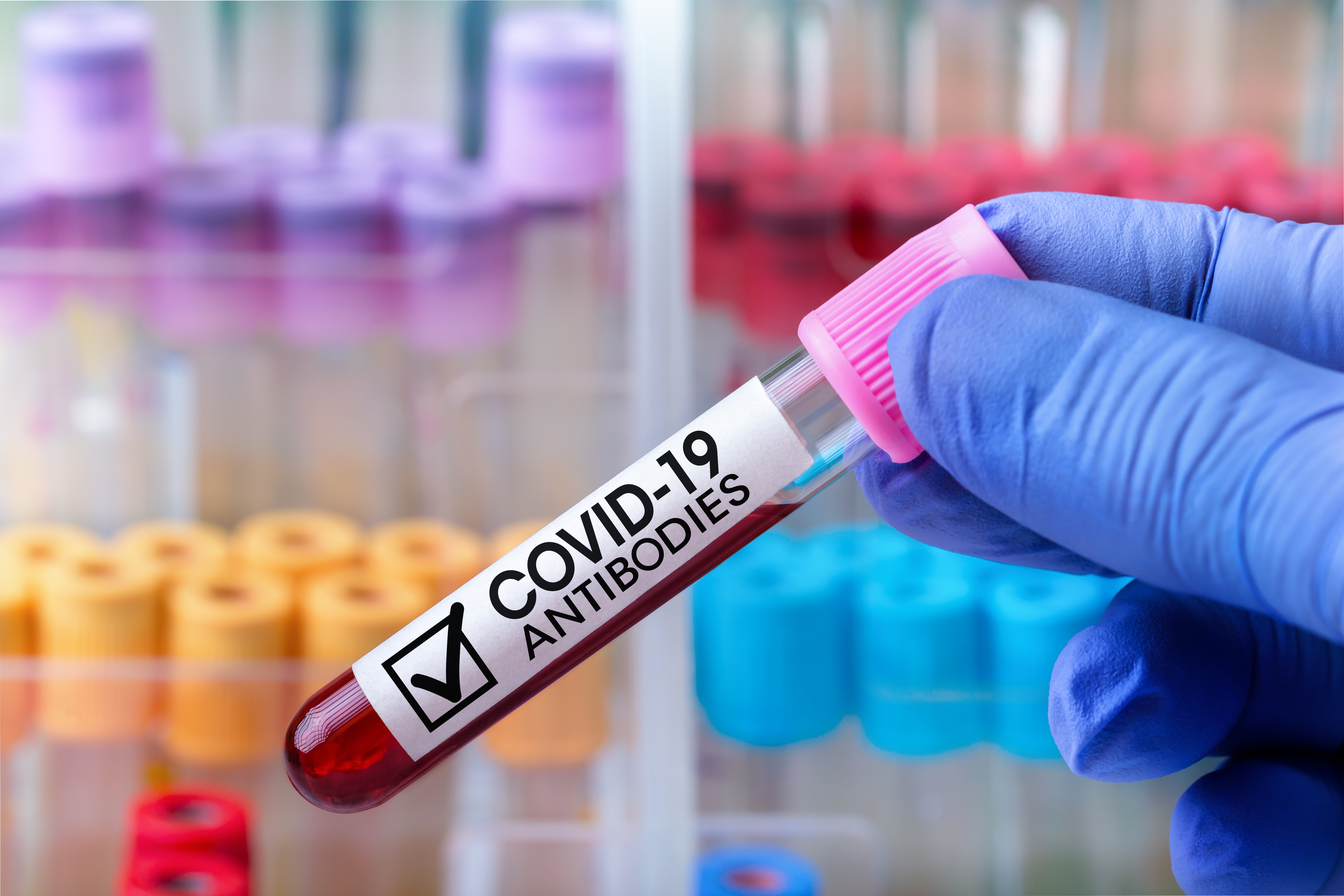 Teste pentru depistarea anticorpilor COVID-19. Când le facem? Explicațiile unui medic de laborator