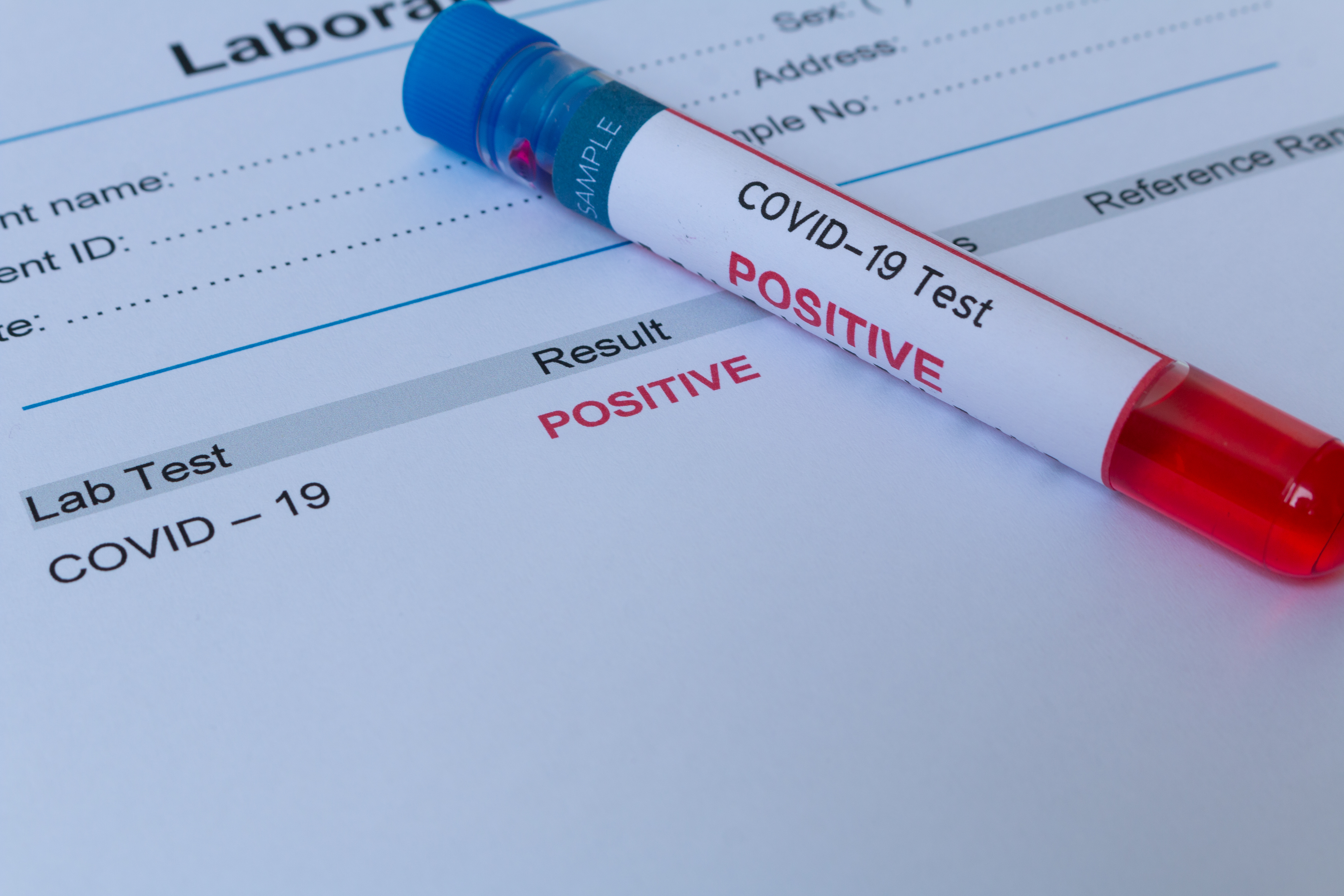 Teste pentru anticorpi COVID-19. Ce semnifică și de ce rezultatele pot fi diferite?
