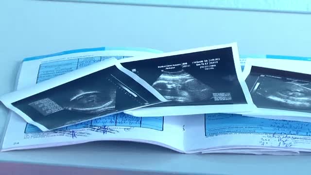 Doua anchete in cazul copilului nascut infirm in Petrosani. Explicatia halucinanta a medicului