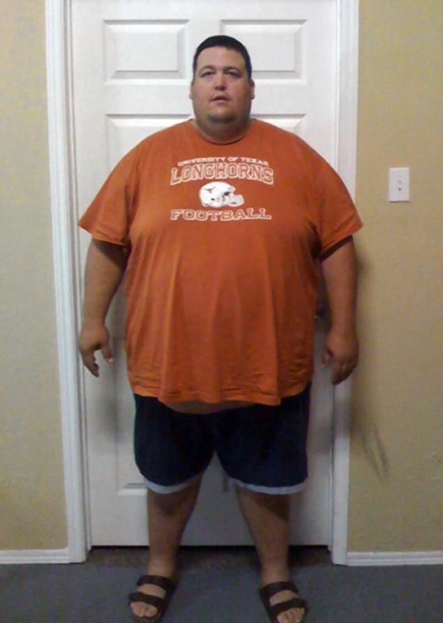 Cum arata acest barbat obez, dupa ce a slabit 136 de kg. 