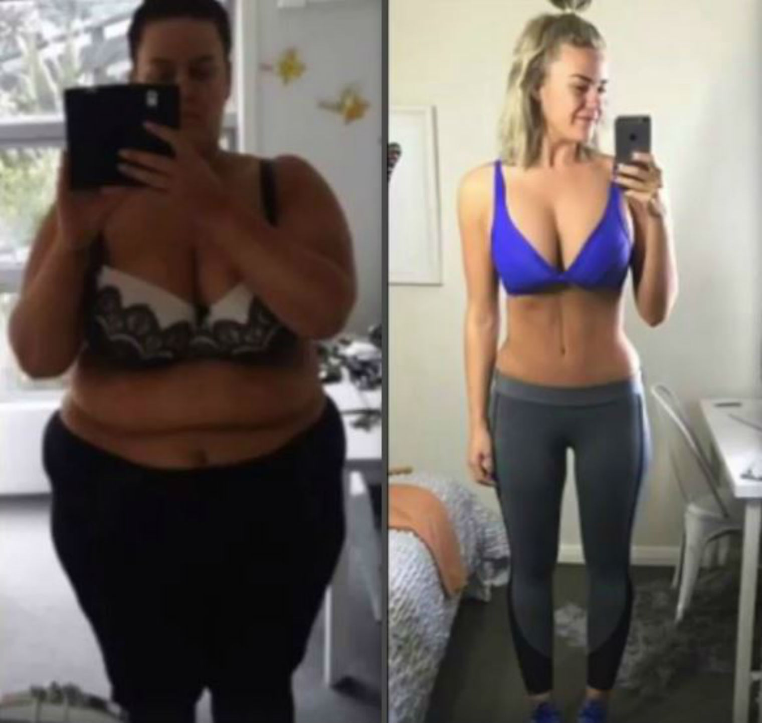 O femeie de 220 de kilograme pierde în greutate)