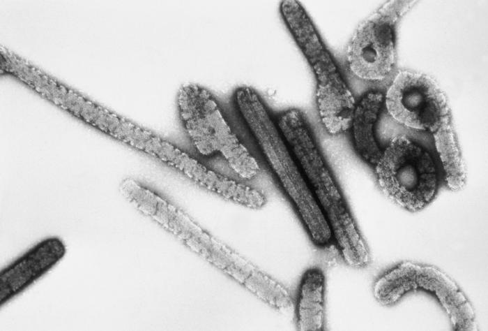Un virus letal a fost descoperit pentru prima dată în vestul Africii. O persoană infectată a murit