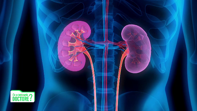 Cum putem preveni pietrele la rinichi și ce trebuie să facem în cazul în care apar