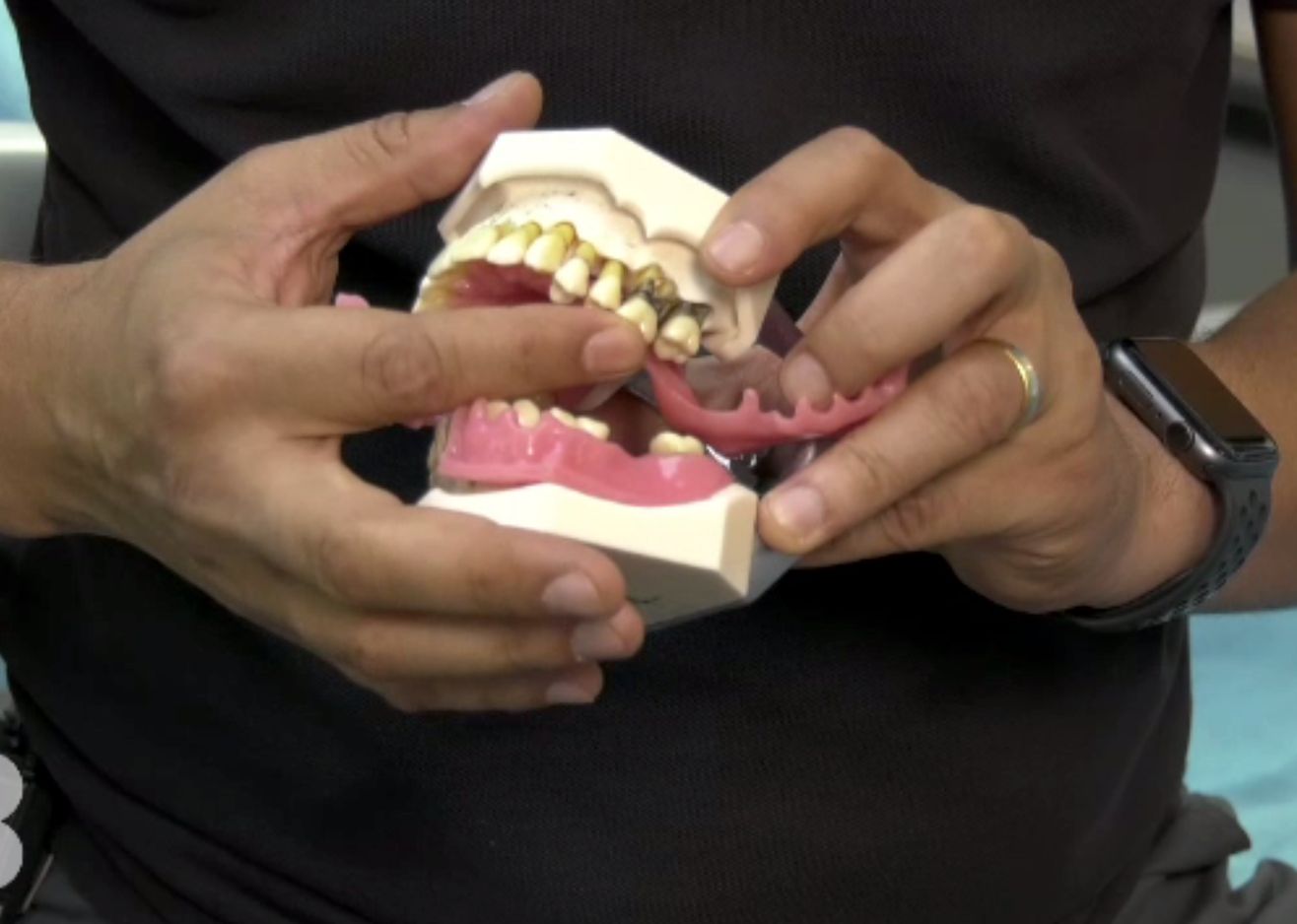 Cum se ajunge de la fumat la parodontoză. Curățarea profundă se face în cabinetul stomatologic
