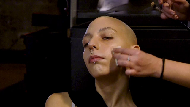 Top-modelele, înlocuite de femei cu afecțiuni ale pielii, la Săptămâna Modei de la Milano. GALERIE FOTO - Imaginea 4