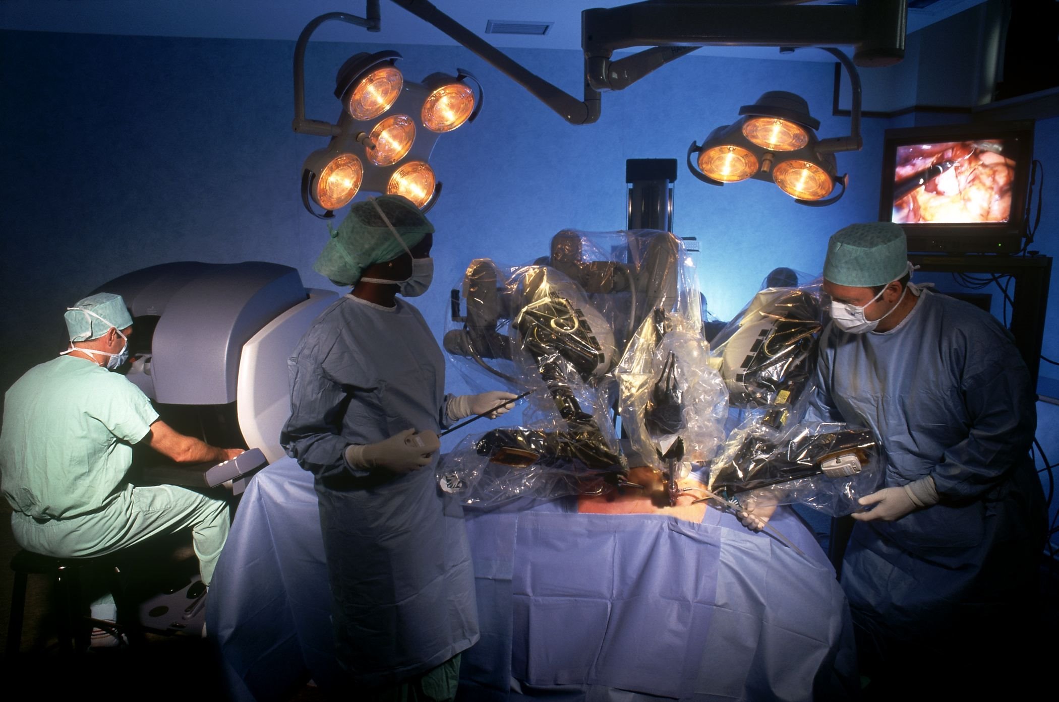 Premiera medicala la Cluj: transplant de rinichi cu robotul 