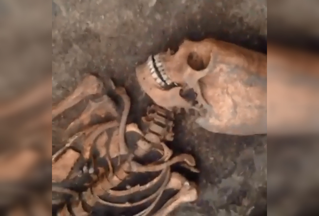 Descoperire bizară în Rusia. Cum arată craniul unei femei moarte în urmă cu foarte mulţi ani. FOTO