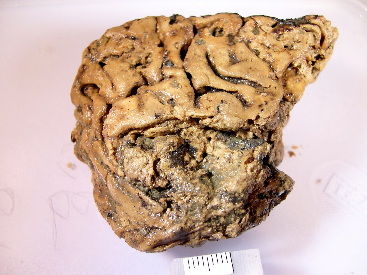 Secretele unui creier uman conservat 2.600 de ani într-un craniu. Ce au descoperit cercetătorii