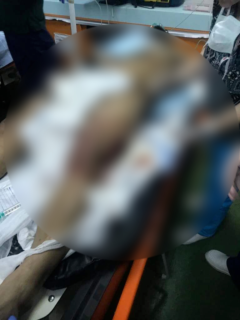 Imagini șocante cu interlopul Bebino, internat în spital după ce fost mutilat de un rival