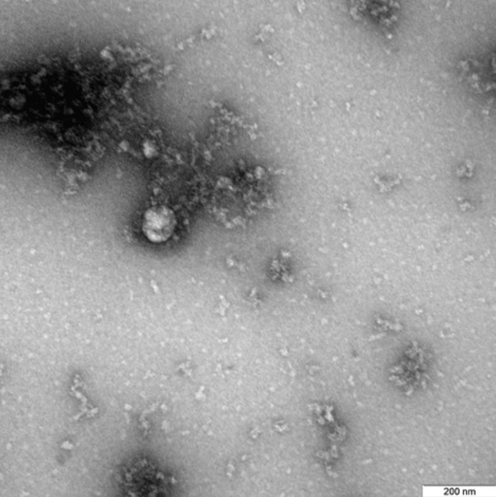 Cum arată tulpina britanică de Covid-19. Primele imagini la microscop. FOTO - Imaginea 1
