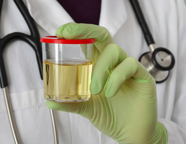 Un antivaccinist susține că propria urină este „antidotul” împotriva Covid-19