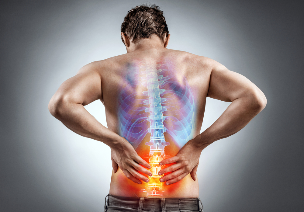 Cercetătorii americani au descoperit un leac pentru durerile de spate. Tratamentul este făcut din plastic