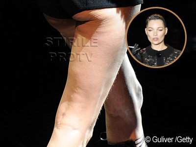 Kate Moss, la 37 de ani. Cu picioarele distruse de celulita pe scena