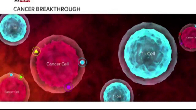 Descoperire extraordinara in tratarea cancerului la san. Rezultate in doar 11 zile, fara chimioterapie