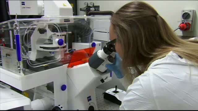 Cercetătorii ar putea crea rinichi artificiali din celule stem, eliminând dializa
