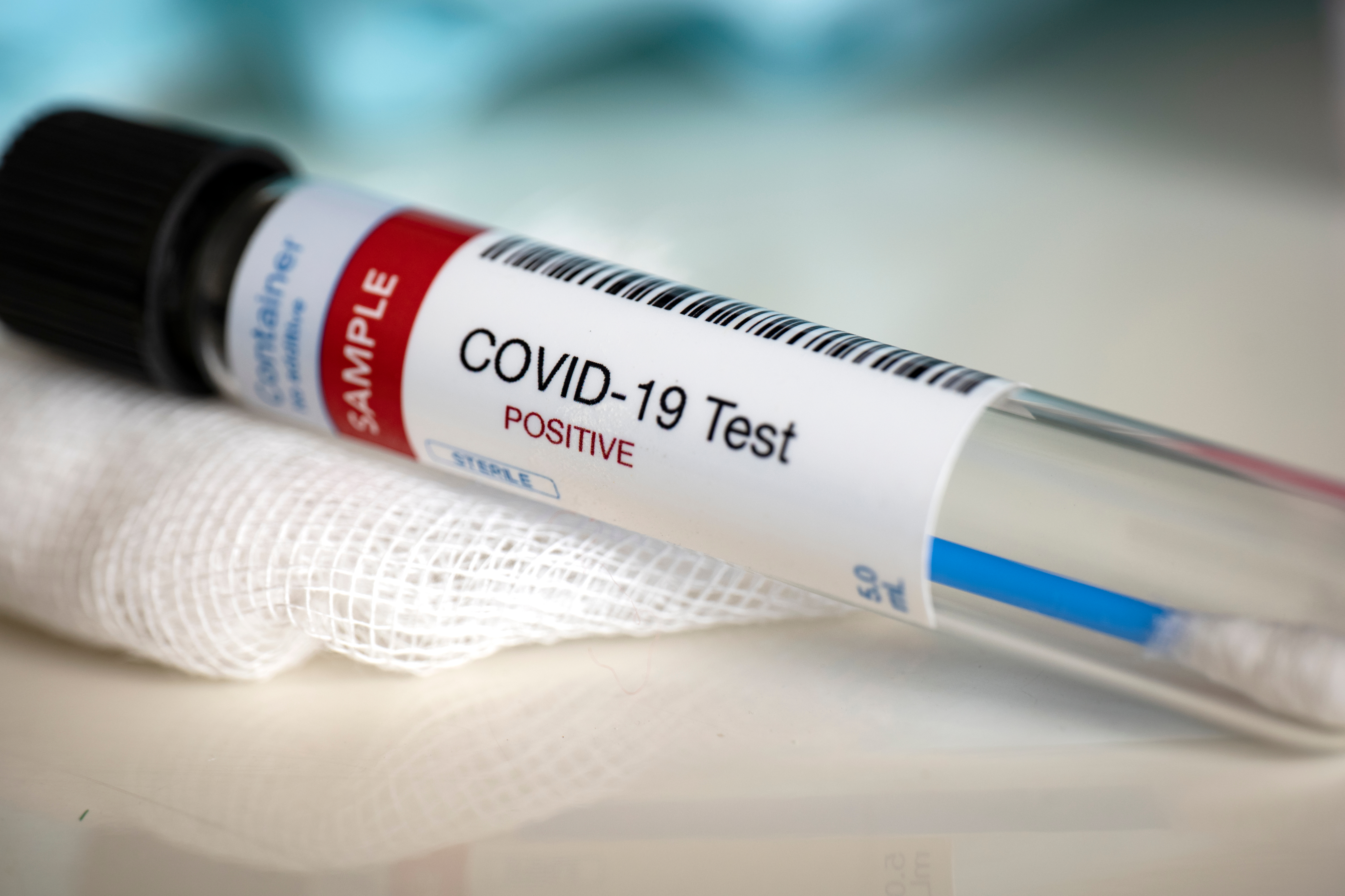 Un tânăr de 22 de ani din Buzău a fost diagnosticat cu COVID-19 pentru a doua oară în decurs de 5 luni