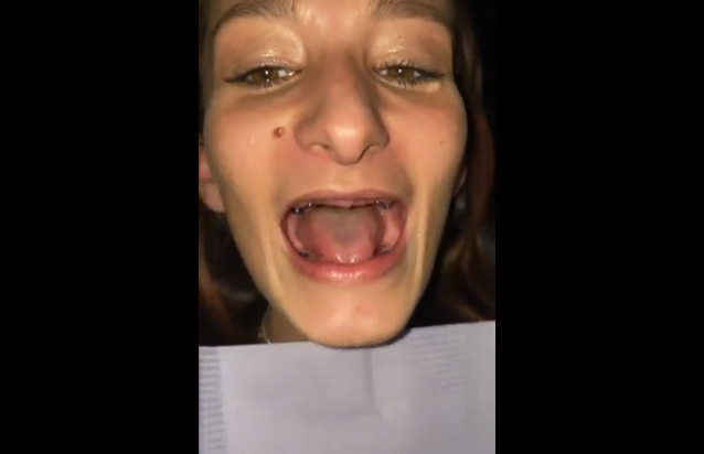 Un dentist i-a scos toți dinții din gură și a trăit un chin. Cum arată după ce a primit o dantură nouă - Imaginea 1