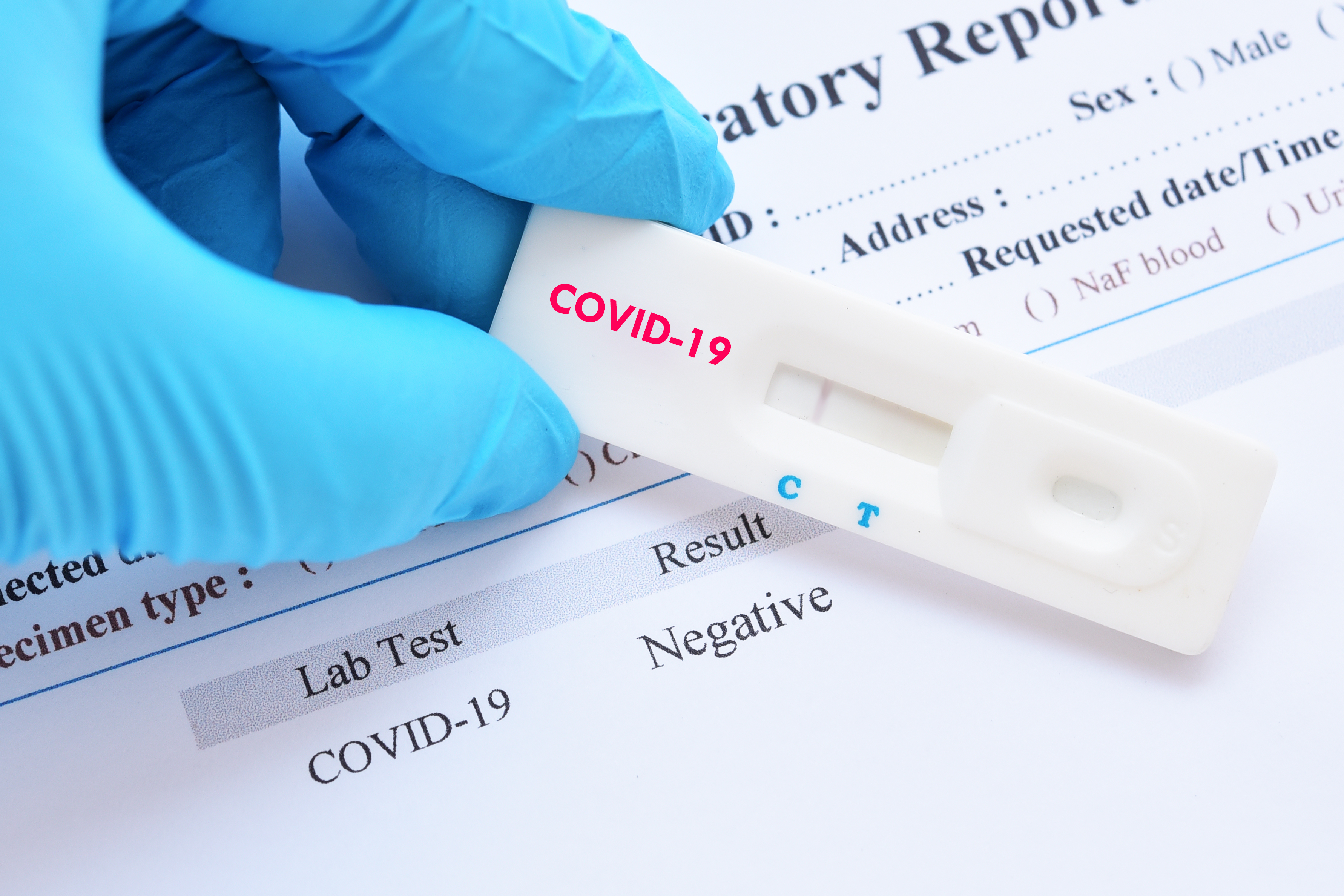 Testarea rapidă în farmacii pentru depistarea COVID-19, aprobată de Ministerul Sănătăţii