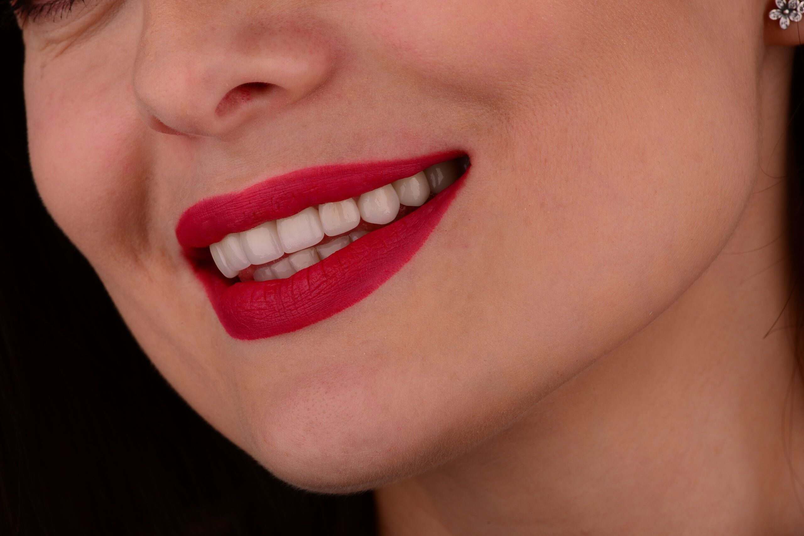 (P) Care sunt cele mai căutate tehnici de estetică dentară pentru un zâmbet impecabil?