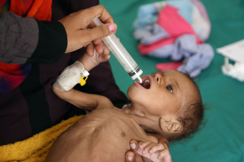 85.000 de copii au murit de foamete în timpul crizei din Yemen