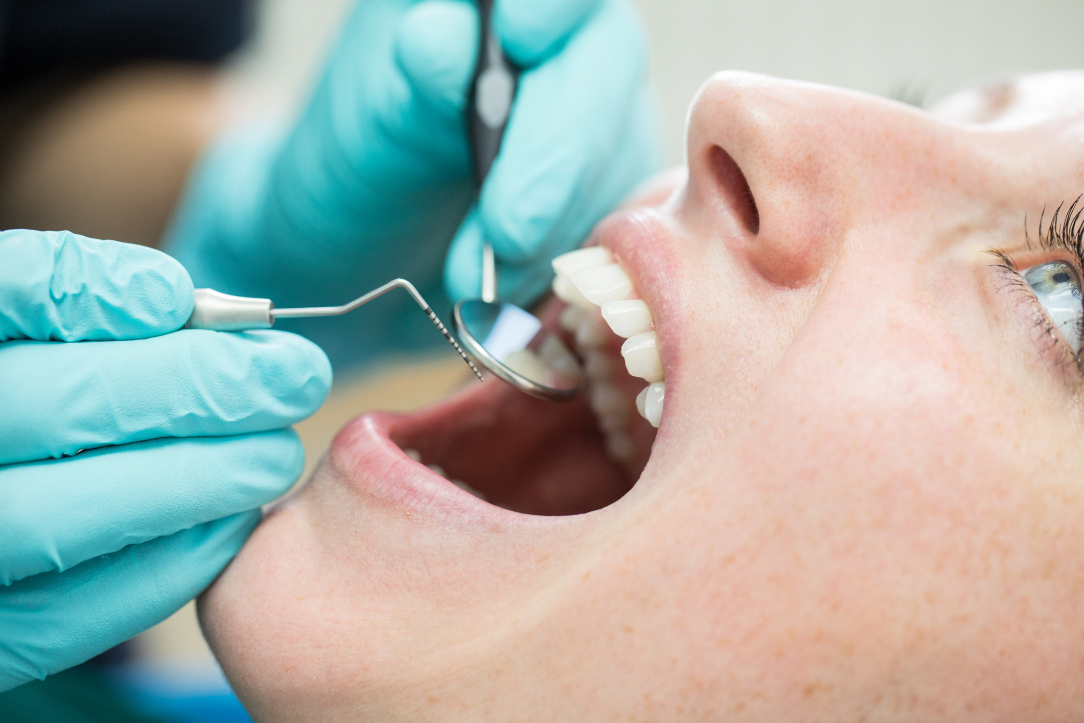 Pierderea dinților ar putea fi o urmare a infecției cu noul coronavirus? Ce spun specialiștii