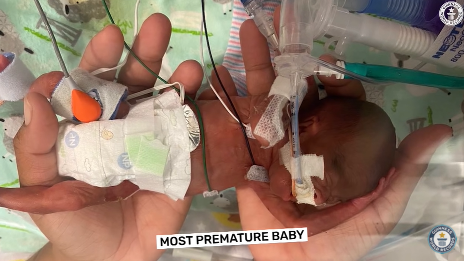 „Cel mai prematur bebeluș”. Un băiețel a supraviețuit după ce s-a născut la doar 21 de săptămâni
