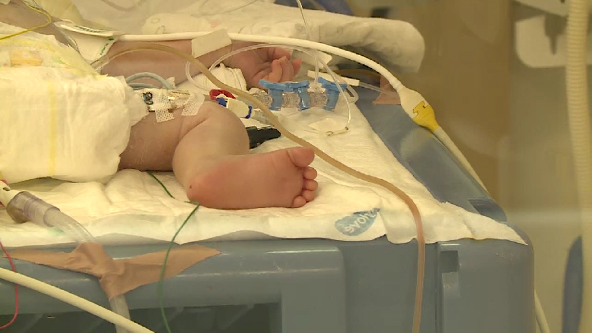 Peste 20.000 de copii se nasc prematur în România, iar pentru aproape jumătate nu sunt paturi