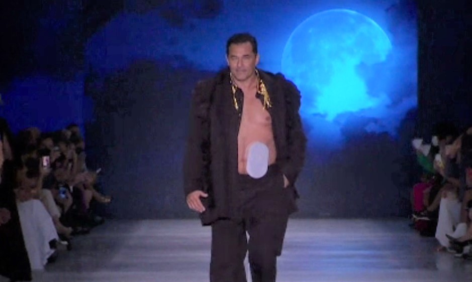 Un actor a defilat pe podimul de la săptămâna modei din Sao Paulo cu un dispozitiv medical montat pe abdomen