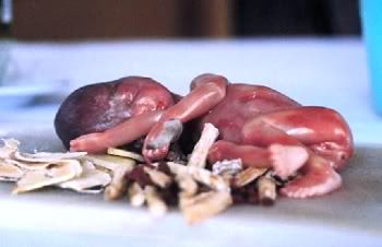 FOTOGRAFII SOCANTE! Supa de fetus uman, delicatesa pentru bogatanii chinezi - Imaginea 3