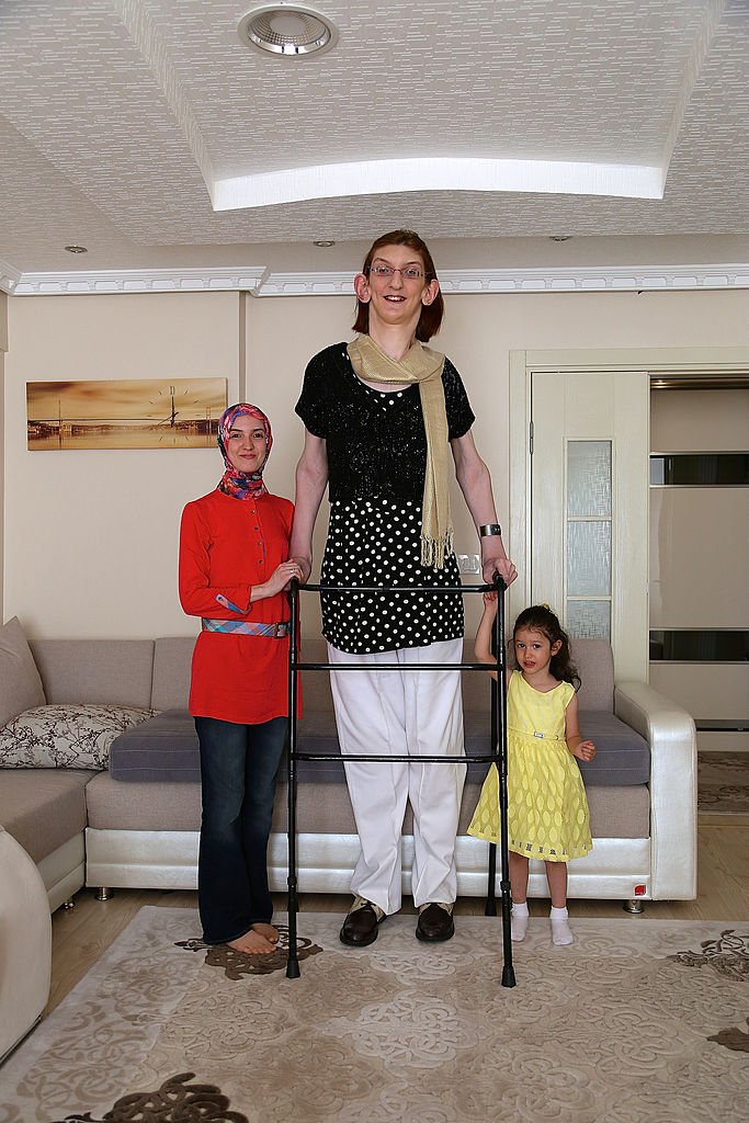 Cea mai înaltă femeie din lume este din Turcia şi are peste 2,15 metri - Imaginea 3