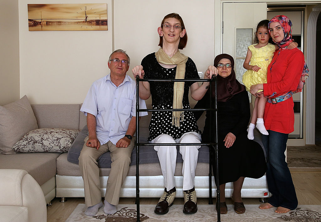 Cea mai înaltă femeie din lume este din Turcia şi are peste 2,15 metri - Imaginea 8